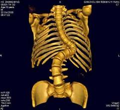 南京强脊诊疗中心