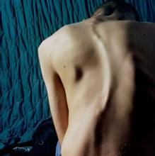 南京强脊诊疗中心